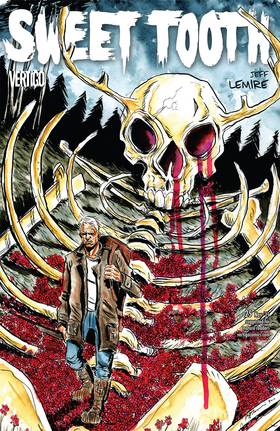 Read Sweet Tooth  34 Page 1 in English
