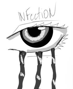 Read Infection  1 Page 1 in Finnish